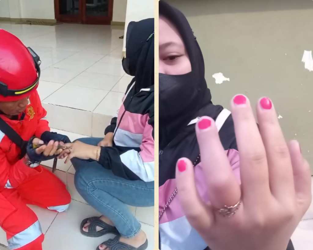 Cincin Tersangkut di Jari, Perempuan Asal Lamongan Panik Datangi Damkar&nbsp;Tuban